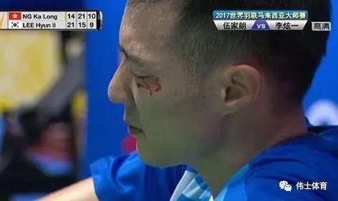 被球击中视力剩0.04被球击中后视力骤降，仅剩0.04，如何应对视力危机？